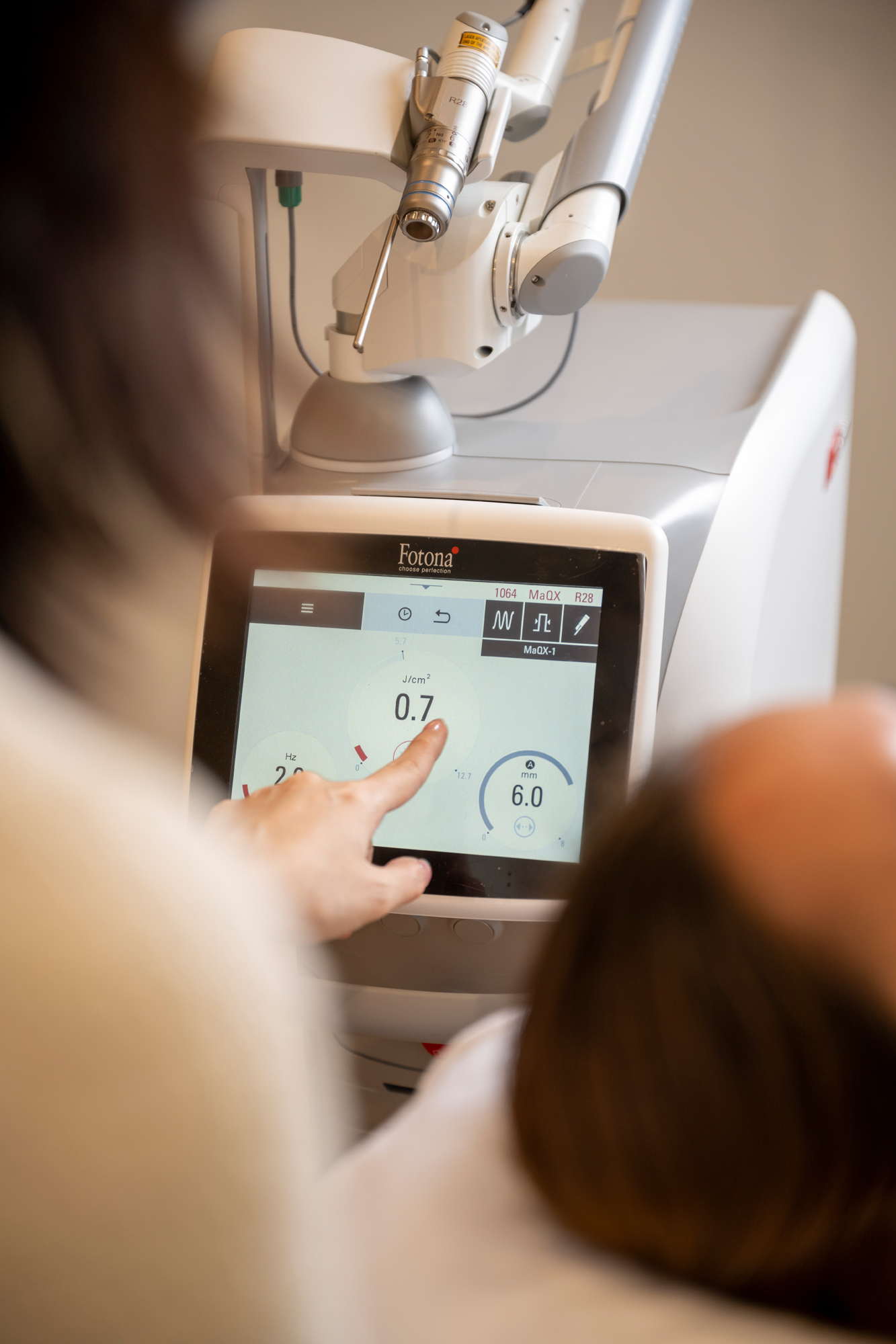 Starwalker picloaser dermstetiq camden medical - dr suan tan singapore