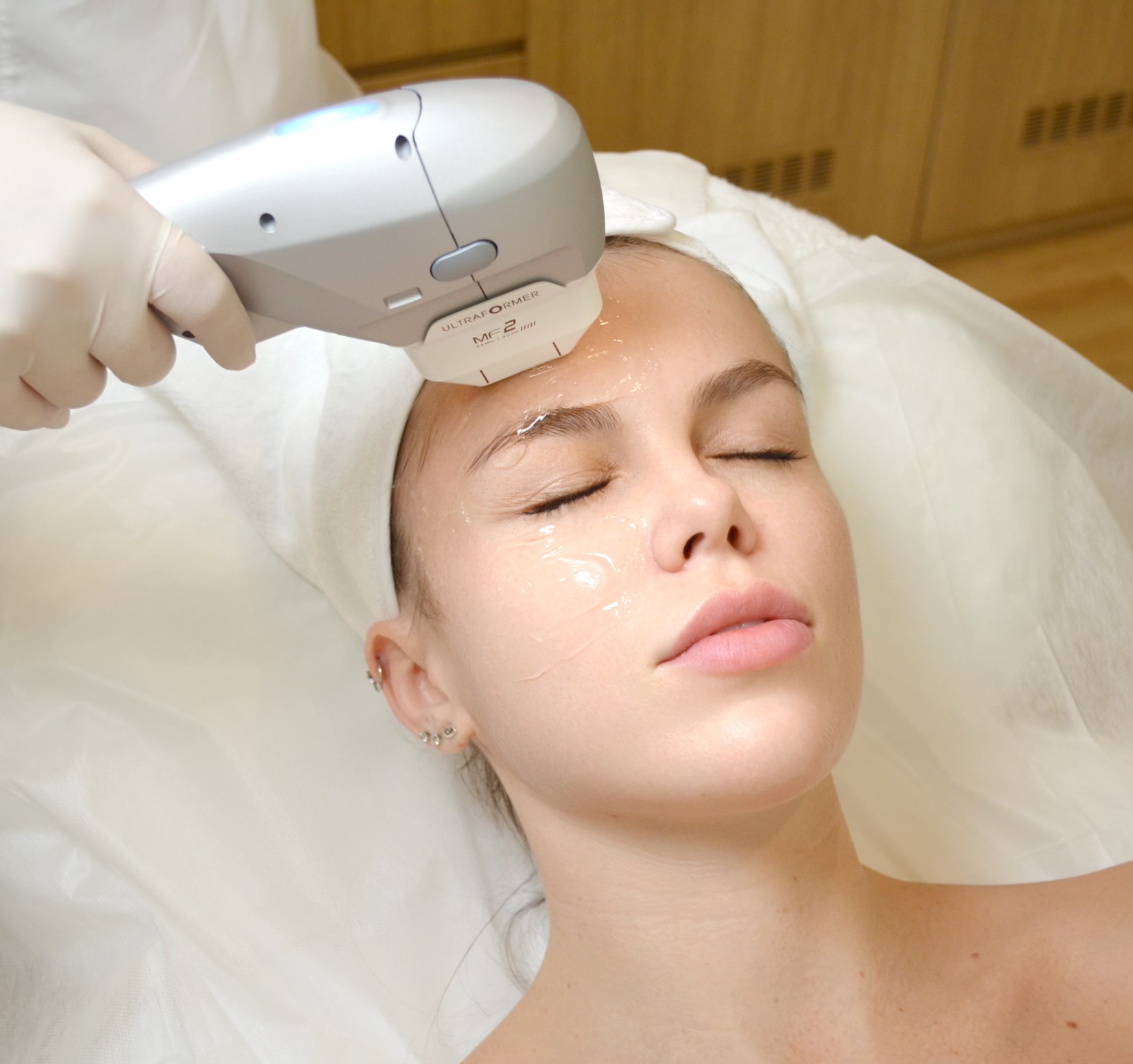 HIFU face treatment | facial lifting | ultrasound | Dermstetiq Clinic