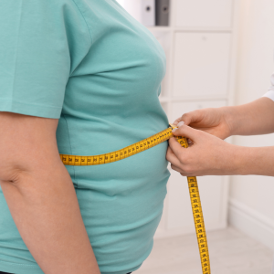 Obesity Prevention and Treatment: A Comprehensive Guide