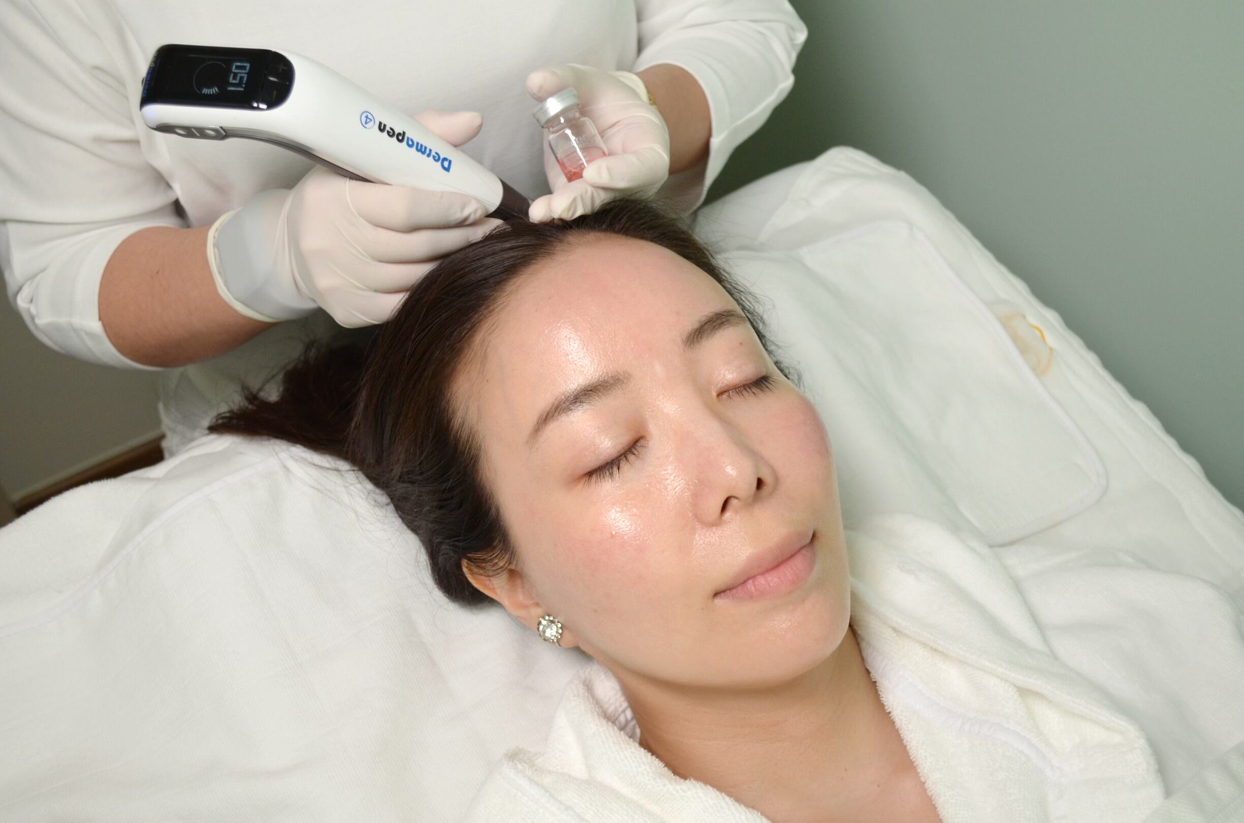 Best Hair Loss Treatment - Dermstetiq Clinic Singapore