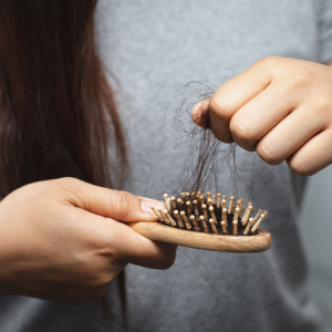 Causes of Hair Loss - Dermstetiq Clinic Singapore