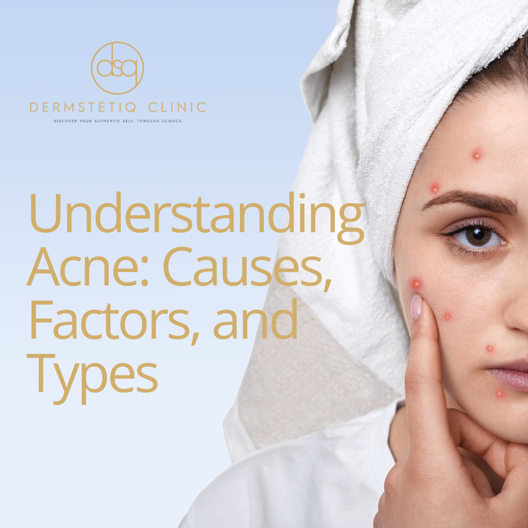 Acne Exposed: Spectacular Insights You'll Love