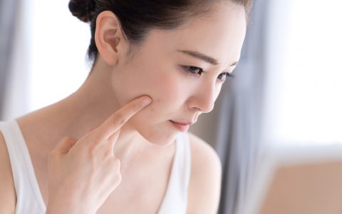 dermstetiq skinconditions_acne